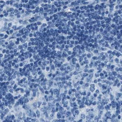 Immunohistochemistry (Formalin/PFA-fixed paraffin-embedded sections) - Anti-AMACR antibody (AB246927)