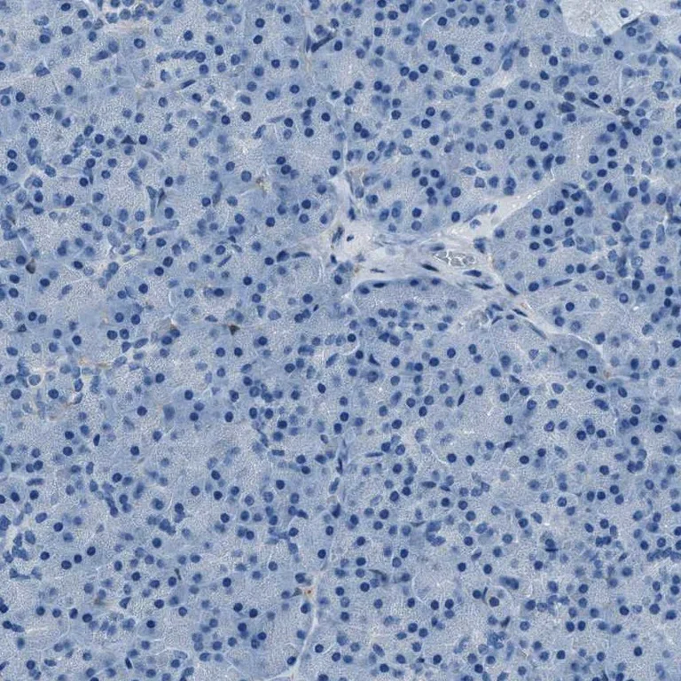 Immunohistochemistry (Formalin/PFA-fixed paraffin-embedded sections) - Anti-AMACR antibody (AB246927)