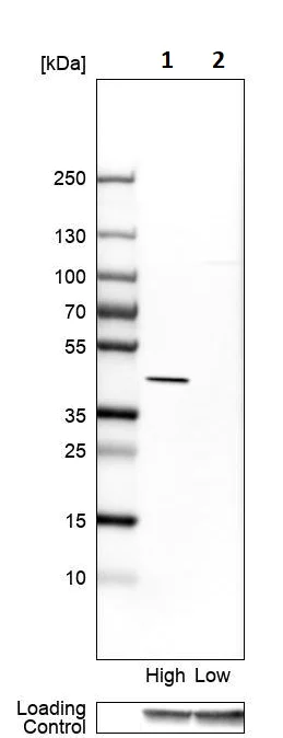 Western blot - Anti-AMACR antibody (AB246927)