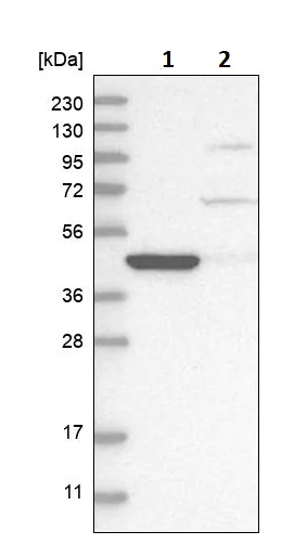 Western blot - Anti-AMACR antibody (AB246927)