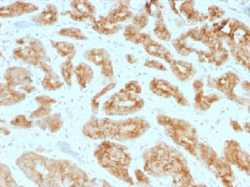 Immunohistochemistry (Formalin/PFA-fixed paraffin-embedded sections) - Anti-AMACR antibody [AMACR/1723] (AB219309)