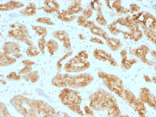 Immunohistochemistry (Formalin/PFA-fixed paraffin-embedded sections) - Anti-AMACR antibody [AMACR/1723] - BSA and Azide free (AB269762)