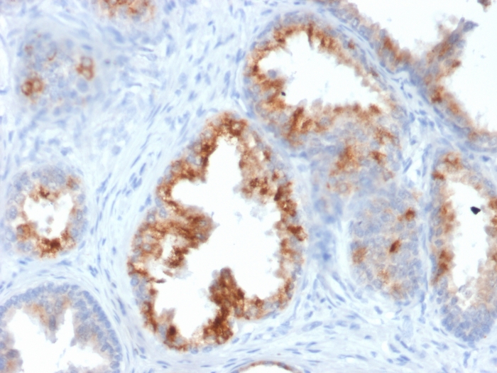 Immunohistochemistry (Formalin/PFA-fixed paraffin-embedded sections) - Anti-AMACR antibody [AMACR/1864] (AB268062), expandable thumbnail