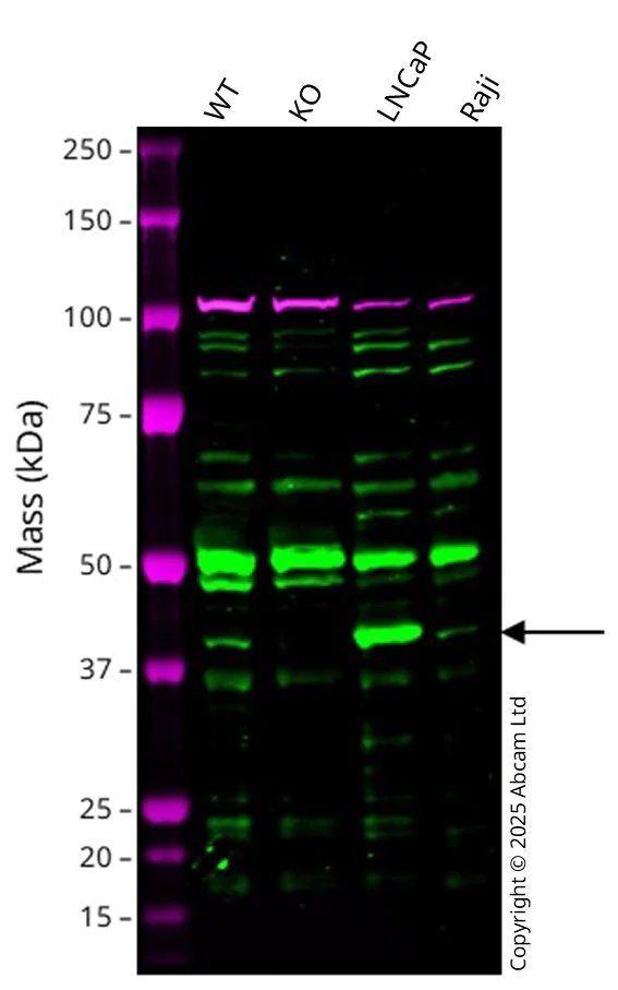 Western blot - Anti-AMACR antibody [AMACR/1864] (AB268062)