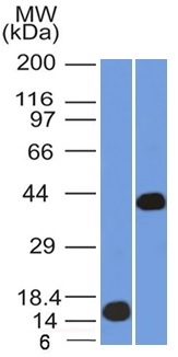 Western blot - Anti-AMACR antibody [AMACR/1864] (AB268062), expandable thumbnail