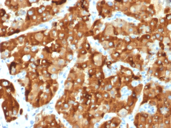 Immunohistochemistry (Formalin/PFA-fixed paraffin-embedded sections) - Anti-AMACR antibody [AMACR/1864] - BSA and Azide free (AB268183)