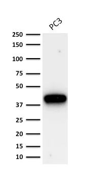 Western blot - Anti-AMACR antibody [AMACR/1864] - BSA and Azide free (AB268183)