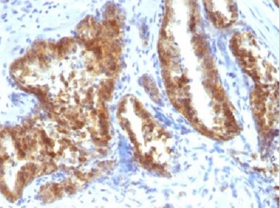 Immunohistochemistry (Formalin/PFA-fixed paraffin-embedded sections) - Anti-AMACR antibody - BSA and Azide free (AB212378)