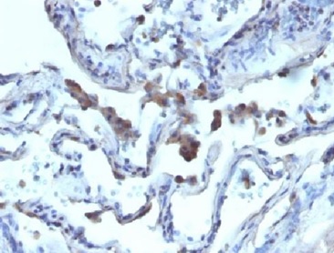 Immunohistochemistry (Formalin/PFA-fixed paraffin-embedded sections) - Anti-AMACR antibody - BSA and Azide free (AB212378)
