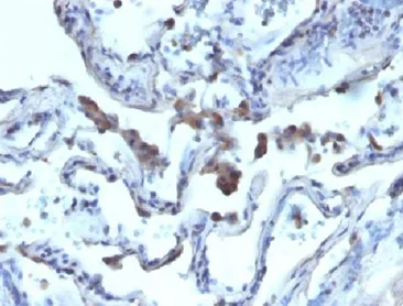 Immunohistochemistry (Formalin/PFA-fixed paraffin-embedded sections) - Anti-AMACR antibody - BSA and Azide free (AB212378)