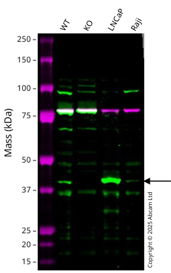 Western blot - Anti-AMACR antibody - BSA and Azide free (AB212378)