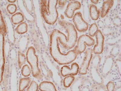 Immunohistochemistry (Formalin/PFA-fixed paraffin-embedded sections) - Anti-AMACR antibody [RM349] - N-terminal (AB238312)