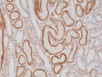 Immunohistochemistry (Formalin/PFA-fixed paraffin-embedded sections) - Anti-AMACR antibody [RM349] - N-terminal (AB238312)