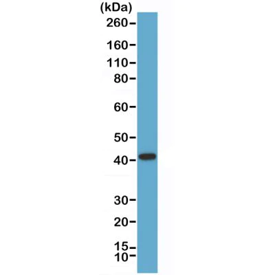 Western blot - Anti-AMACR antibody [RM349] - N-terminal (AB238312)