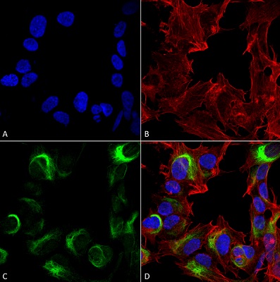 Immunocytochemistry/ Immunofluorescence - Anti-AMBRA1 antibody (AB223351)