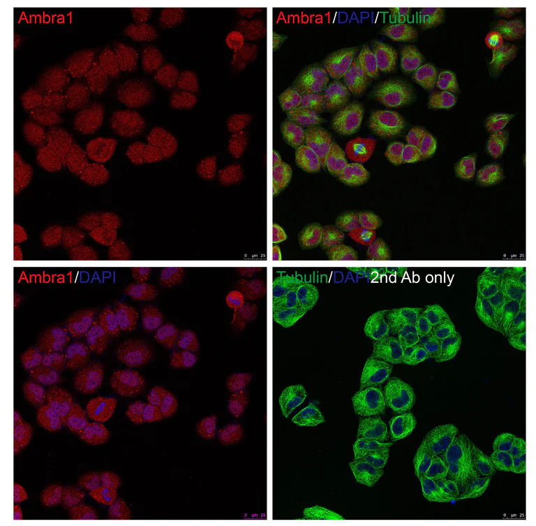 Immunocytochemistry/ Immunofluorescence - Anti-AMBRA1 antibody (AB69501)
