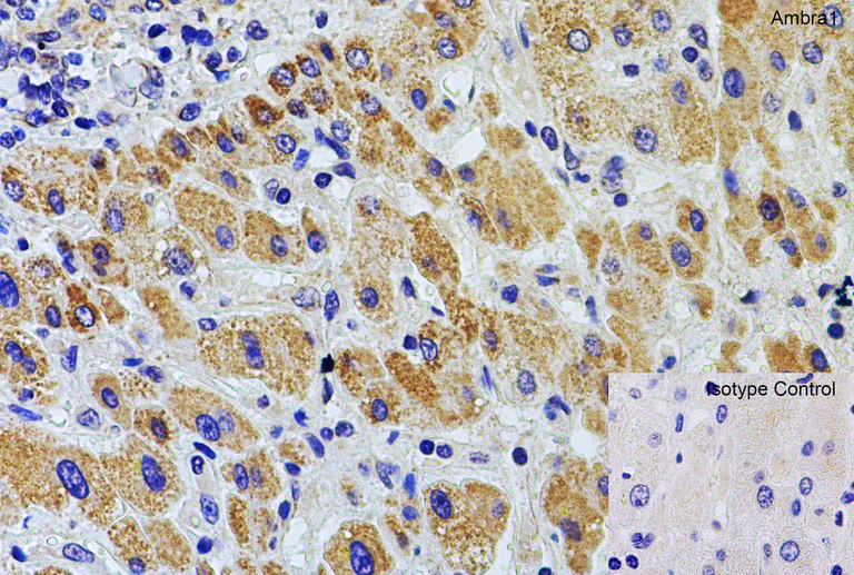 Immunohistochemistry (Formalin/PFA-fixed paraffin-embedded sections) - Anti-AMBRA1 antibody (AB69501)