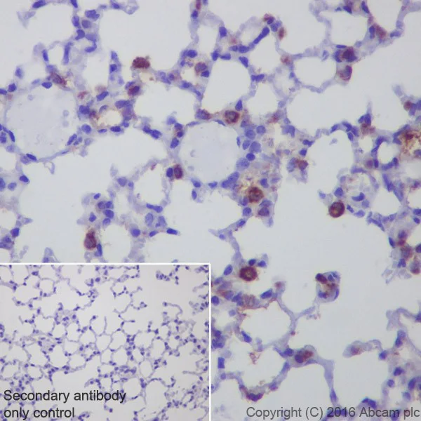 Immunohistochemistry (Formalin/PFA-fixed paraffin-embedded sections) - Anti-AMCase antibody [EPR19984] (AB207169)