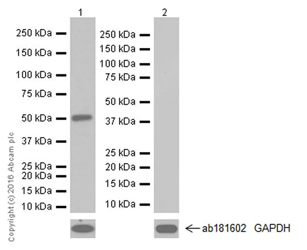 Western blot - Anti-AMCase antibody [EPR19984] (AB207169)