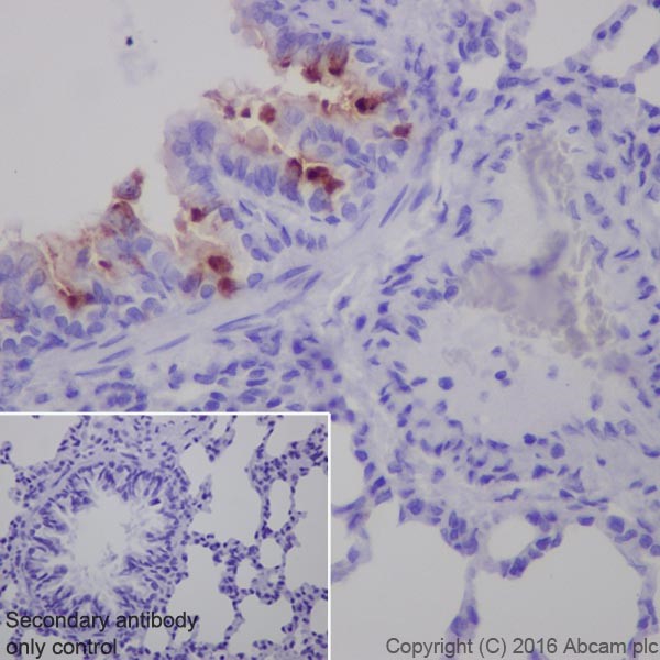 Immunohistochemistry (Formalin/PFA-fixed paraffin-embedded sections) - Anti-AMCase antibody [EPR19985] (AB207168)