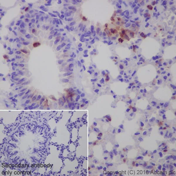 Immunohistochemistry (Formalin/PFA-fixed paraffin-embedded sections) - Anti-AMCase antibody [EPR19985] (AB207168)
