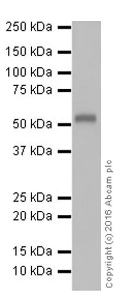 Western blot - Anti-AMCase antibody [EPR19985] (AB207168)