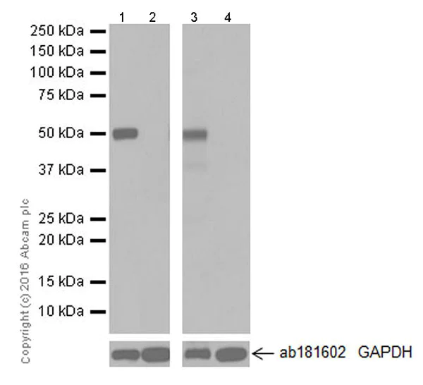 Western blot - Anti-AMCase antibody [EPR19985] (AB207168)