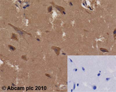 Immunohistochemistry (Formalin/PFA-fixed paraffin-embedded sections) - Anti-AMF antibody [1B7D7] (AB66340), expandable thumbnail