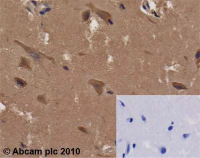 Immunohistochemistry (Formalin/PFA-fixed paraffin-embedded sections) - Anti-AMF antibody [1B7D7] (AB66340)