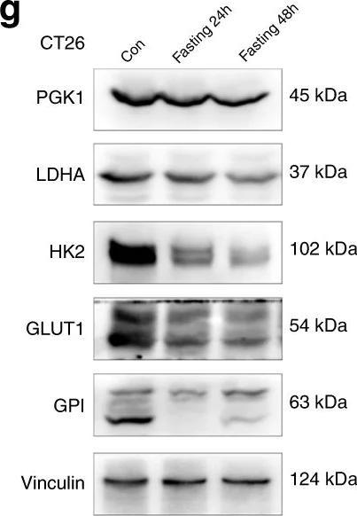 Western blot - Anti-AMF antibody [1B7D7] (AB66340)