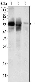 Western blot - Anti-AMF antibody [1B7D7] (AB66340)