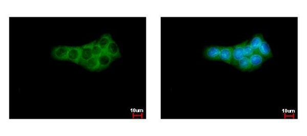 Immunocytochemistry/ Immunofluorescence - Anti-AMF antibody (AB227472), expandable thumbnail