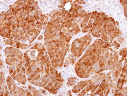 Immunohistochemistry (Formalin/PFA-fixed paraffin-embedded sections) - Anti-AMF antibody (AB227472), expandable thumbnail