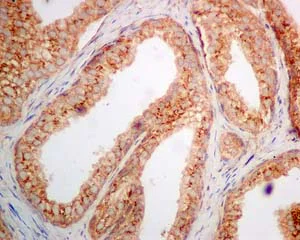 Immunohistochemistry (Formalin/PFA-fixed paraffin-embedded sections) - Anti-AMF antibody [EPR11663(B)] (AB167394)