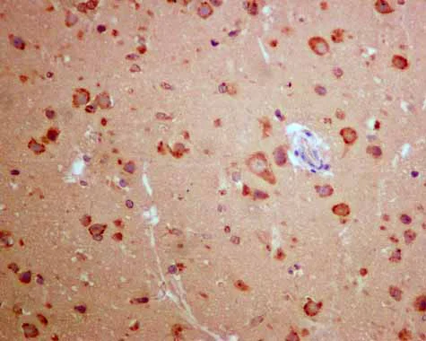 Immunohistochemistry (Formalin/PFA-fixed paraffin-embedded sections) - Anti-AMF antibody [EPR11663(B)] (AB167394)