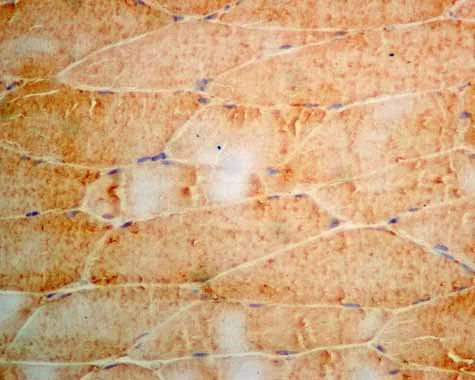 Immunohistochemistry (Formalin/PFA-fixed paraffin-embedded sections) - Anti-AMF antibody [EPR11663(B)] (AB167394)