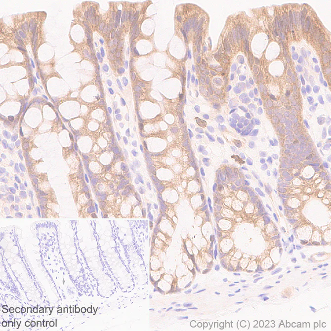 AMF抗体[EPR28372-33] (ab313589)| Abcam中文官网