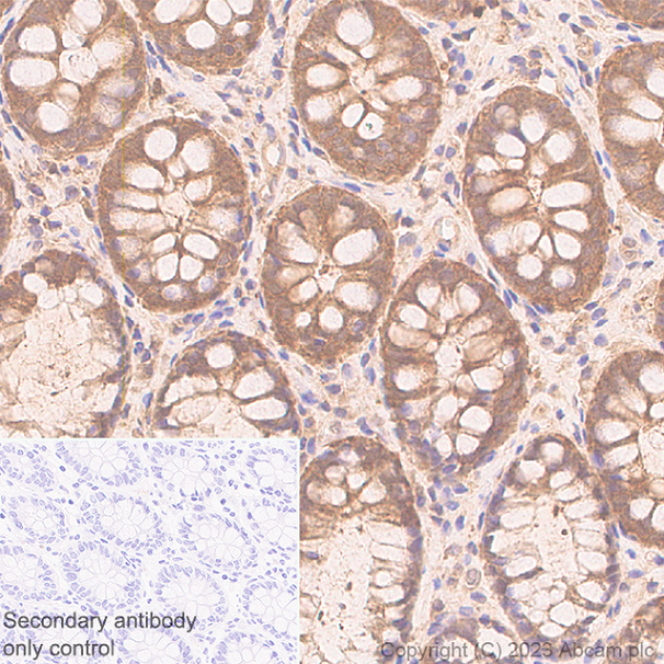 Immunohistochemistry (Formalin/PFA-fixed paraffin-embedded sections) - Anti-AMF antibody [EPR28372-33] - BSA and Azide free (AB313590)