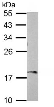 Western blot - Anti-AMG antibody (AB153915)