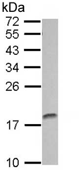 Western blot - Anti-AMG antibody (AB153915)