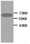Western blot - Anti-AMH antibody (AB84415)