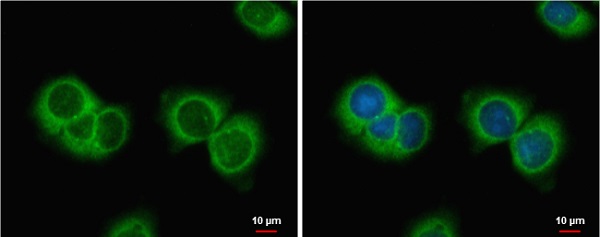 Immunocytochemistry/ Immunofluorescence - Anti-AMH antibody - C-terminal (AB229212), expandable thumbnail