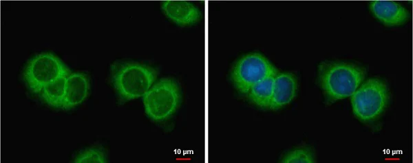 Immunocytochemistry/ Immunofluorescence - Anti-AMH antibody - C-terminal (AB229212)