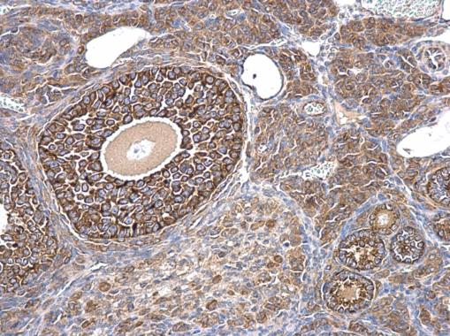 Immunohistochemistry (Formalin/PFA-fixed paraffin-embedded sections) - Anti-AMH antibody - C-terminal (AB229212), expandable thumbnail