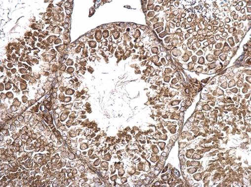 Immunohistochemistry (Formalin/PFA-fixed paraffin-embedded sections) - Anti-AMH antibody - C-terminal (AB229212), expandable thumbnail
