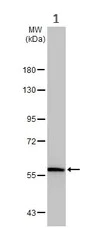 Western blot - Anti-AMH antibody - C-terminal (AB229212)