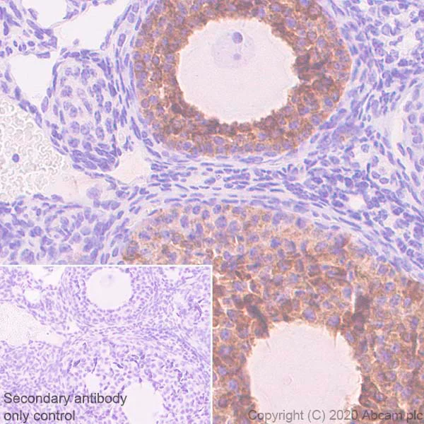 Immunohistochemistry (Formalin/PFA-fixed paraffin-embedded sections) - Anti-AMH antibody [EPR23380-171] (AB272221)