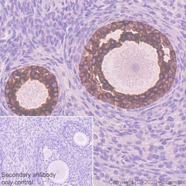 Immunohistochemistry (Formalin/PFA-fixed paraffin-embedded sections) - Anti-AMH antibody [EPR23380-171] (AB272221)
