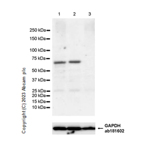 Western blot - Anti-AMH antibody [EPR25835-27] (AB313767)