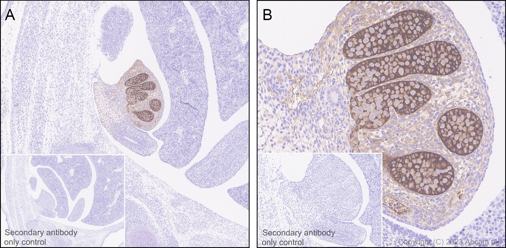 Immunohistochemistry (Formalin/PFA-fixed paraffin-embedded sections) - Anti-AMH antibody [EPR25835-27] - BSA and Azide free (ab313768), expandable thumbnail